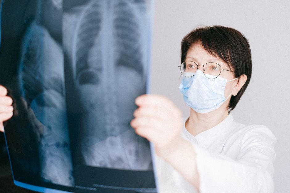 Imaging review of the kind used to support an asbestos lung cancer VA claim